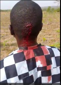 Ibrahim Omole one of the farmers attacked with machetted